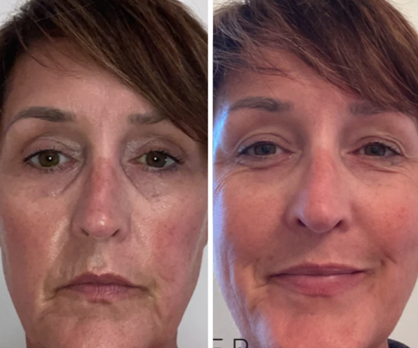 Calm Lavender Hydrosol Toner image 3