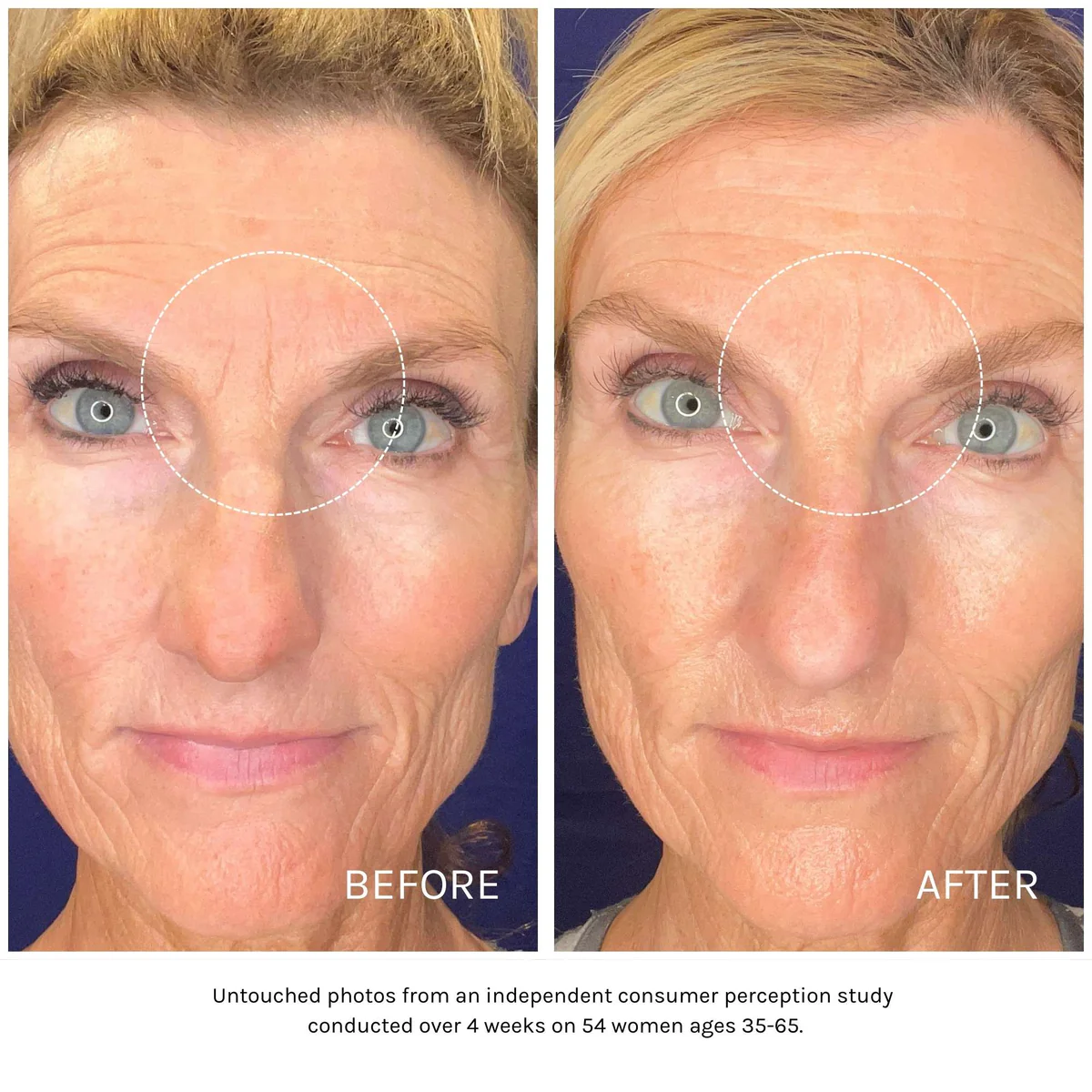 Essential Peptide Serum image 1