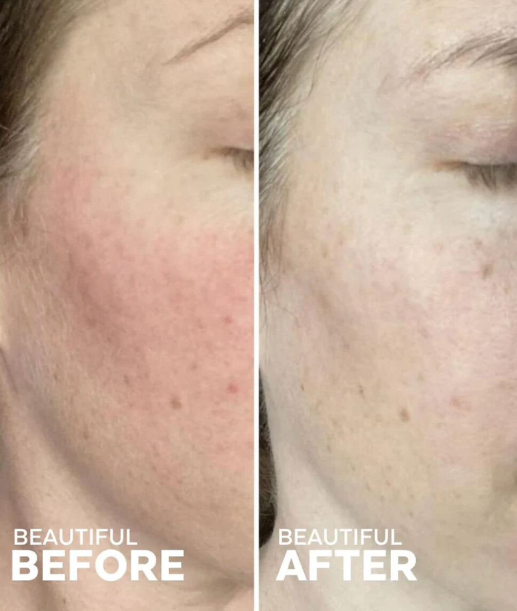 Calm Lavender Hydrosol Toner image 4