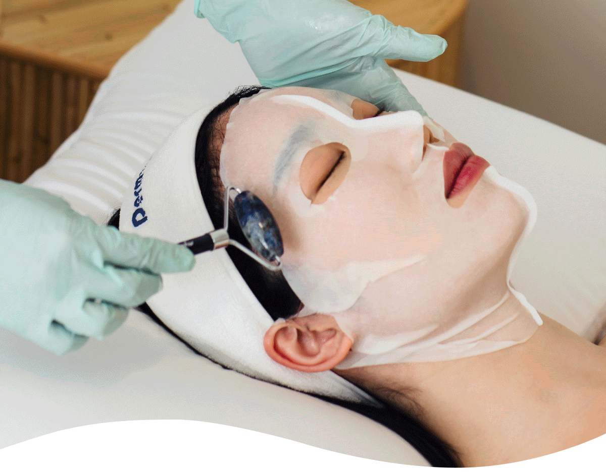 Microneedling Session