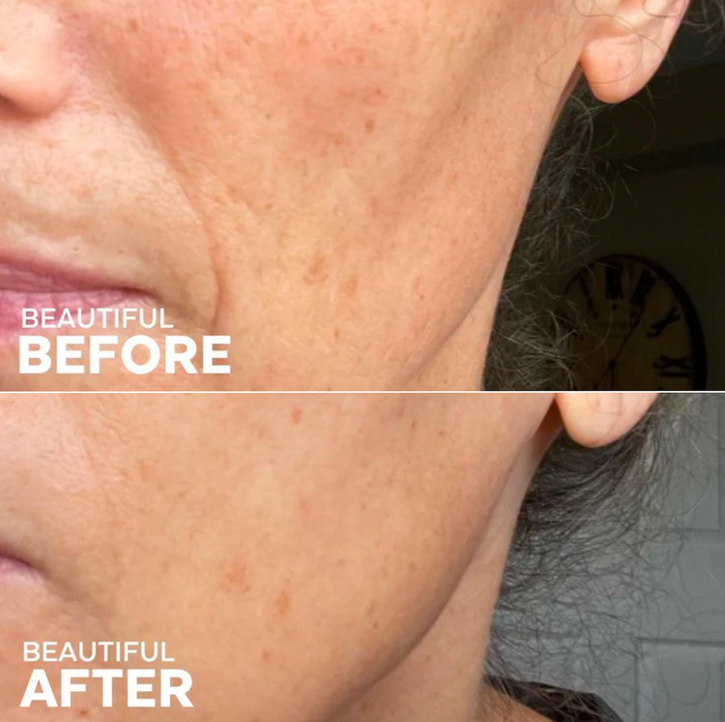 Boost 49% Rosehip Oil Serum