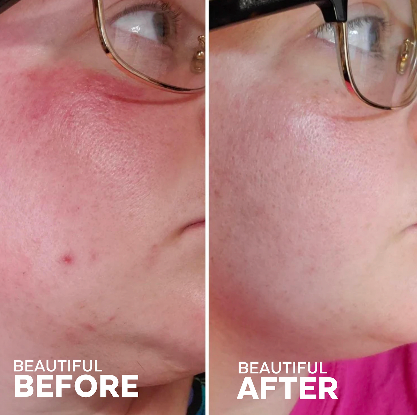 Radiance Grape Stem Cell + Squalane Day Cream