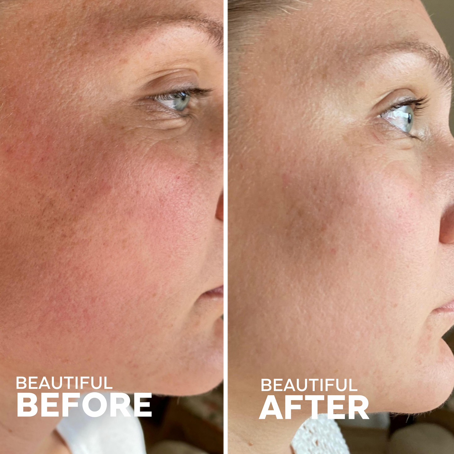 Skin Hero Bakuchiol + Calendula Bio-Retinol Serum